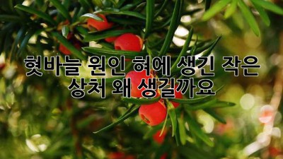 혓바늘 원인: 혀에 생긴 작은 상처, 왜 생길까요?